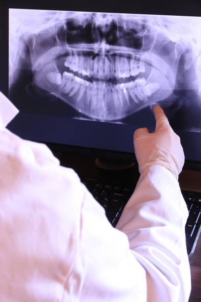 Best Emergency Dentist for Knocked-Out Tooth in High Point, FL