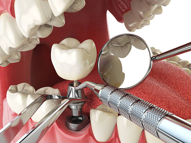 Best Holiday Emergency Dentist in High Point, FL